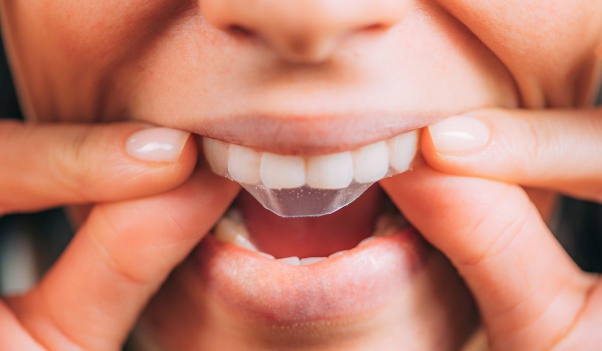 Whitestrips or Teeth Whitening Strips