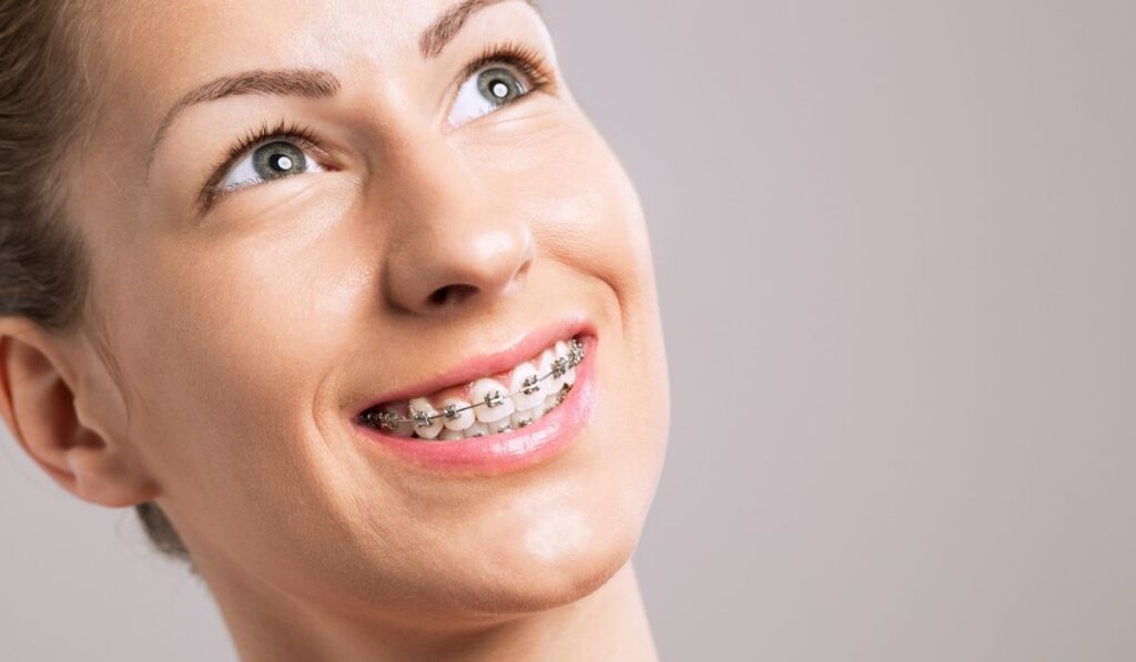 Braces Teeth Female Smile