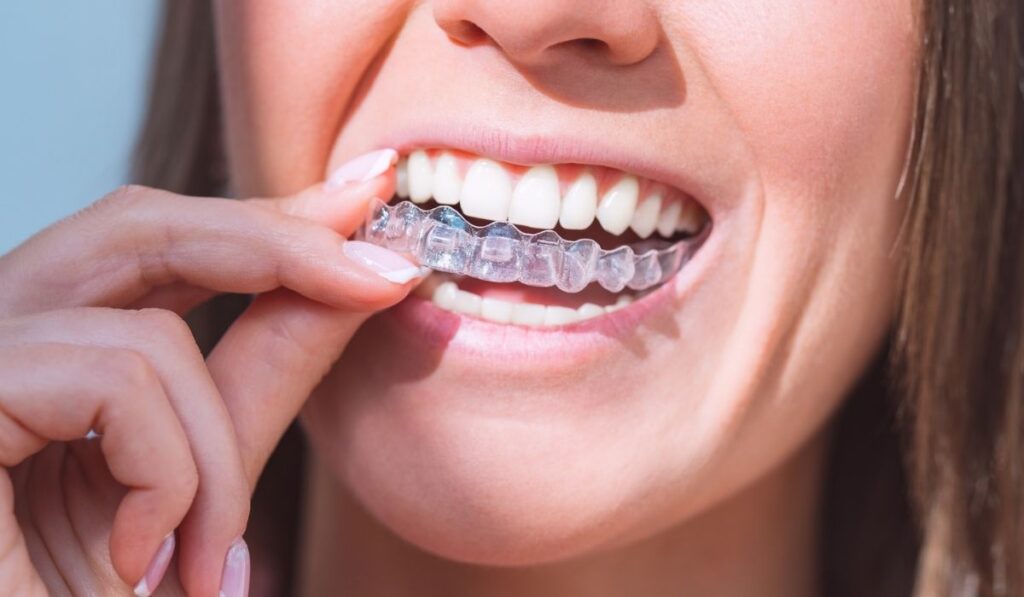 Woman with perfect smile wearing invisible dental aligners 
