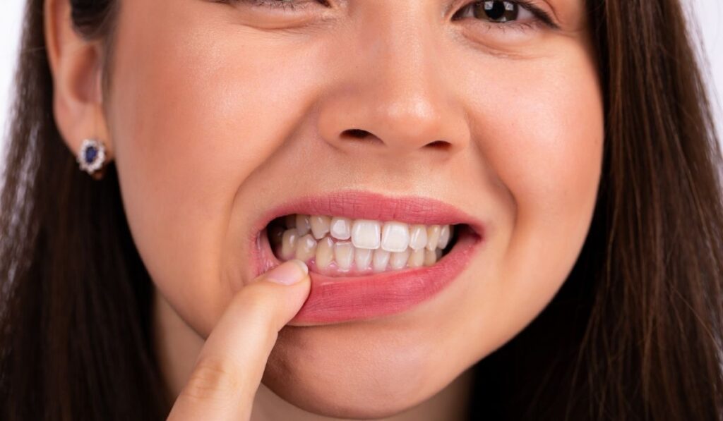 Young beautiful woman touches her teeth with her finger on the lower jaw 