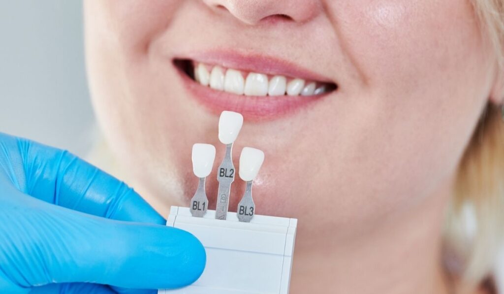 Dentistry matching colour of the tooth enamel 