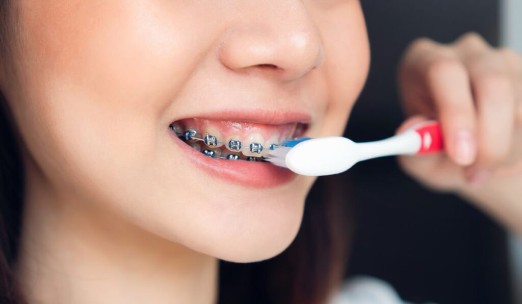 Women are brushing teeth that wear braces 