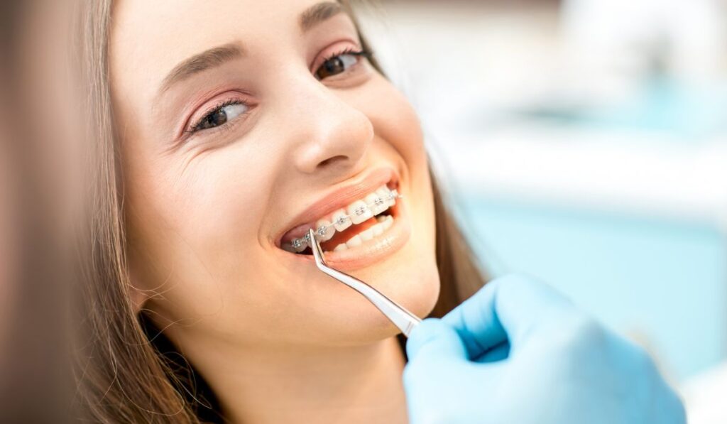 Woman`s smile with dental braces 