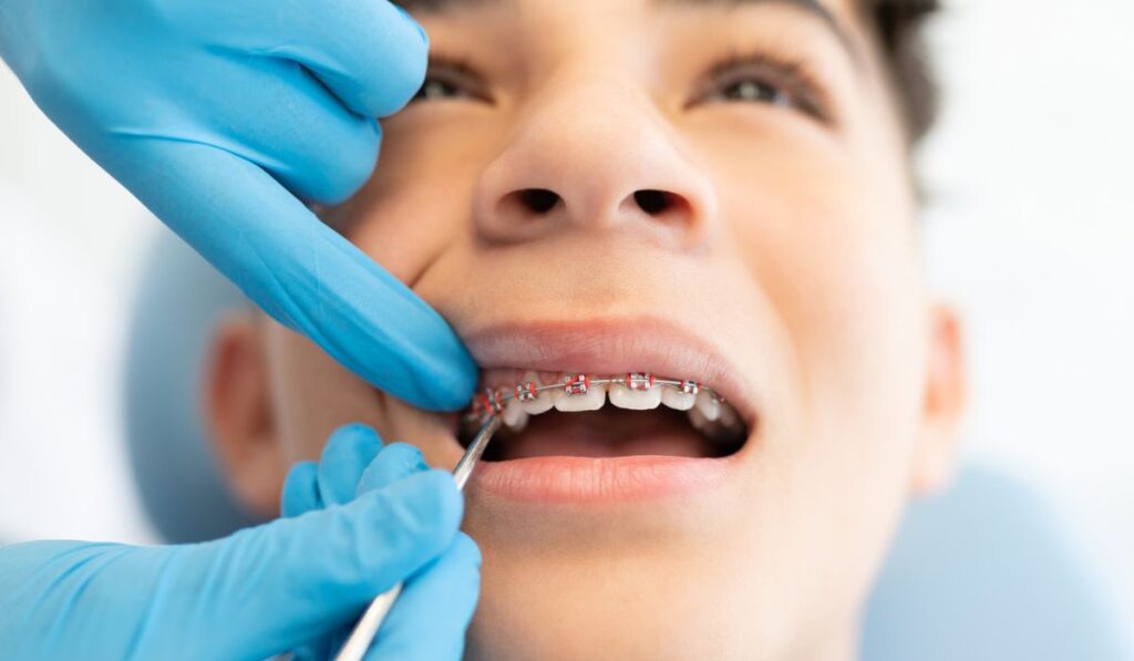 Boy Visiting Dental Clinic For Treatment Of Braces