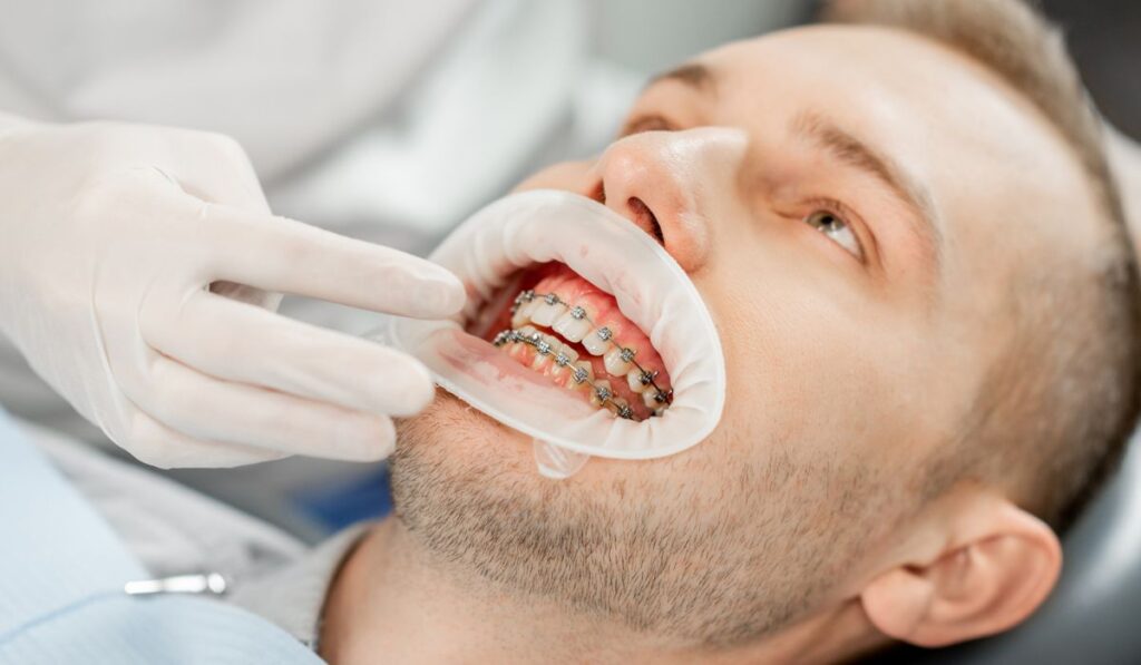Patient with dental braces during a regular orthodontic visit