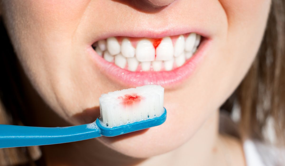 Woman with bleeding gums during teeth brushing